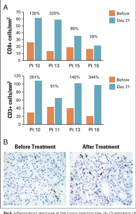 Table 1 From Intratumoral Injection Of Dendritic Cells Engineered To