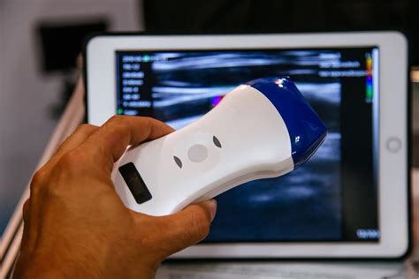 The Future of Ultrasound is Here: Handheld Portable Ultrasound Devices ...