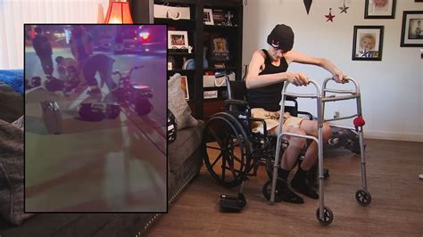 Glendale Teen Left With Broken Legs Looking For Hit And Run Driver