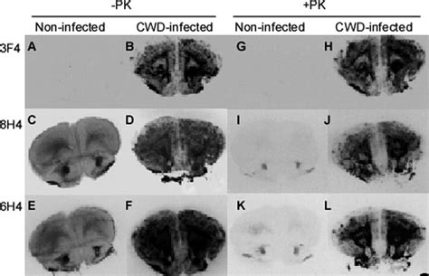 Histoblotting Of Prp In Brain Tissue From Normal And Cwd Infected