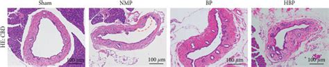 Changes of bile duct histology and liver function. (a, b) HE staining ...