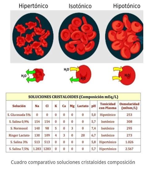 Cuadro Comparativo Mostrando La Composici N De Las Soluciones