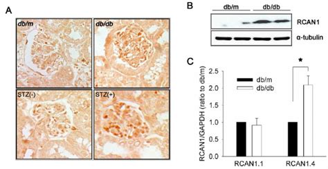 Rcan Expression In The Kidneys Of Diabetic Mouse Models A