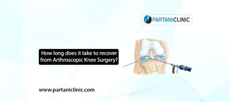 How Long Does It Take To Recover From Knee Arthroscopic Surgery