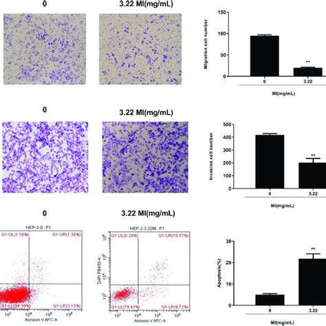 Mi Inhibits Laryngeal Cancer Cell Migration And Invasion And Enhances