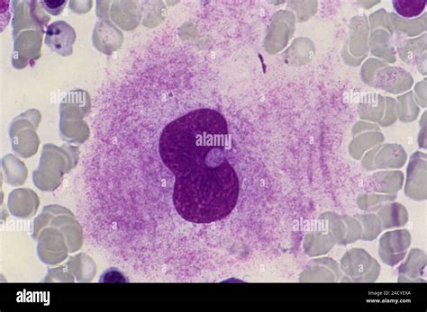 Bone Marrow With Megakaryocyte Light Micrograph Of A Section Through A