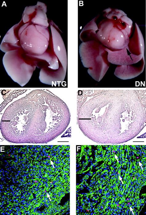 Regulation Of Cardiomyocyte Proliferation And Myocardial Growth During