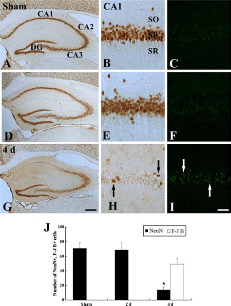 Neun Immunohistochemistry Left And Middle Columns And F J B