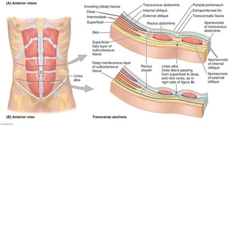 Abdominal Wall Group Discussion Flashcards Quizlet