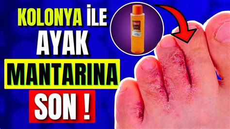 Kolonya ile ayak mantarına ne iyi gelir Ayak mantarı nasıl geçer Ayak