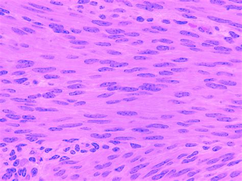 Smooth Muscle Cells