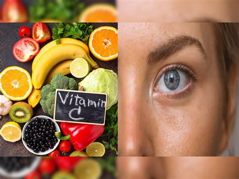 Vitamin C Deficiency Diseases In Body Symptoms Of Vitamin C Deficiency Kknow Vitamin C Rich