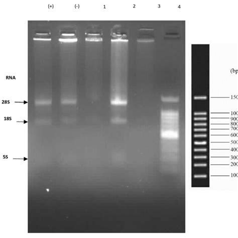 Agarose Gel Photograph Of Rna Extraction Of Rd Cells Treated With Spl Download Scientific