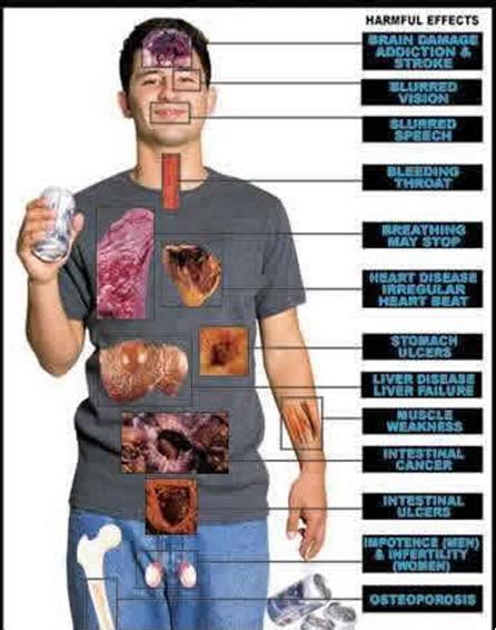 The Devastating Consequences Of Dui Davidazizipersonalinjury