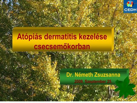 PPT At Pi S Dermatitis Kezel Se Csecsemokorban PowerPoint