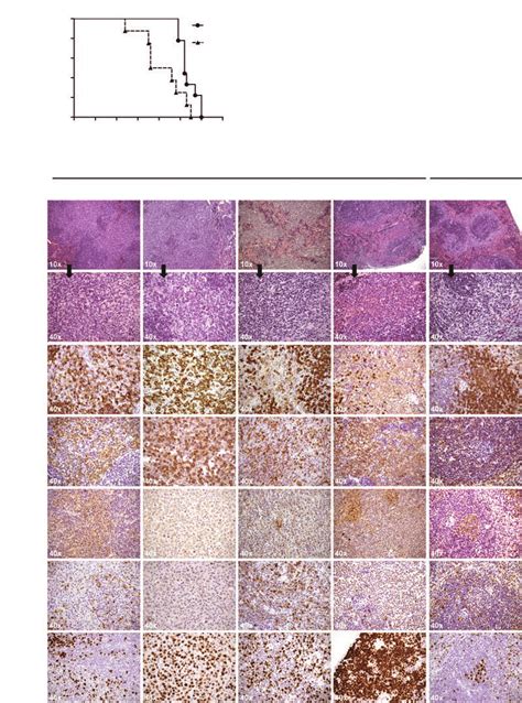 Development Of B Cell Lymphoproliferative Disorders In Aged Siglecg −−