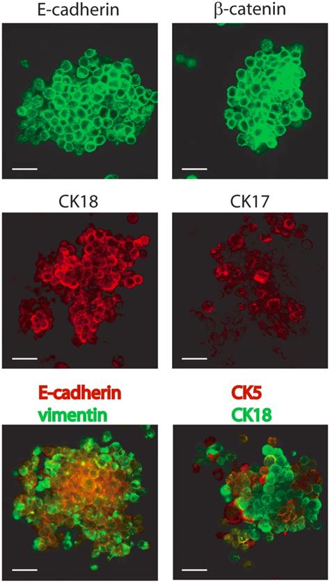 Immunofluorescence Of Dkat Tumorspheres Stained For E Cadherin Download Scientific Diagram