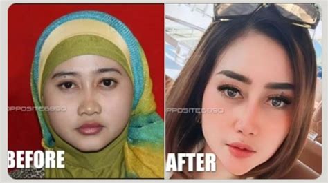 Foto Jadul Luluk Nuril Beredar Perubahan Dagu Dan Alis Bikin Salfok