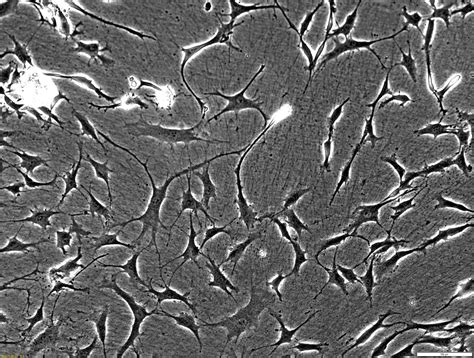 Cellvo Human Chondrocytes Stembiosys