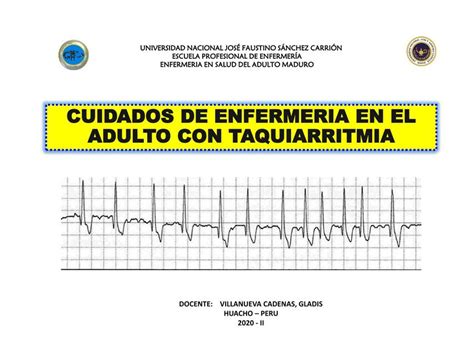 Taquiarritmias BARRÓN MARTINEZ JENNIFER uDocz