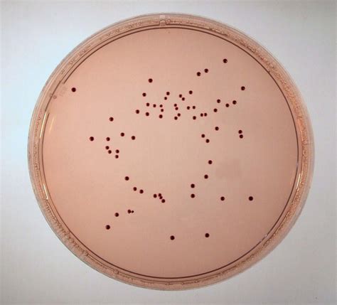 Enterococcus Faecalis Streak Plate