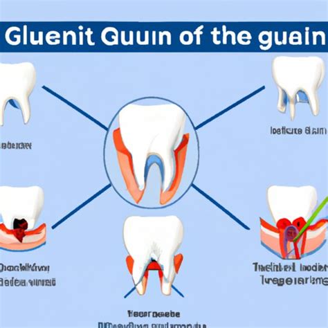 Why Do My Gums Hurt Understanding Causes Prevention And Treatment Of