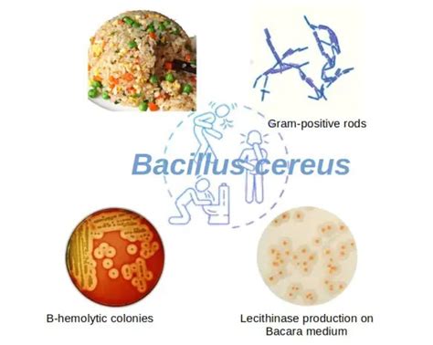 Bacillus cereus: Morphology, Disease, Biochemical Tests • Microbe Online