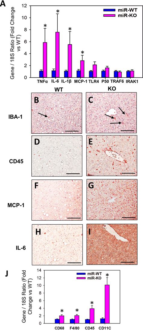 Mir 146a Deficiency Increased Hfd Induced Hepatic Inflammation A