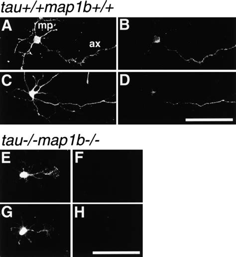 Expression And Cellular Localization Of Tau And MAP1B In Hippocampal