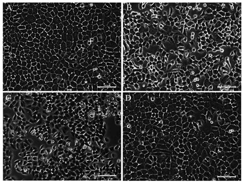 Morphological Characteristics Of Cultured Bgc 823 Cells As Visualized