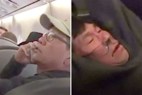 United Passenger Dragged Off Flight Reaches Amicable Settlement With