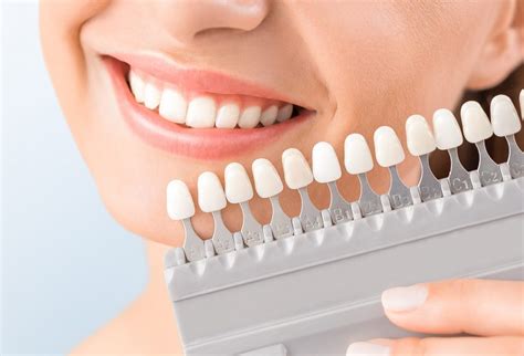 Preguntas Frecuentes Sobre Blanqueamiento Dental Simetria Dental