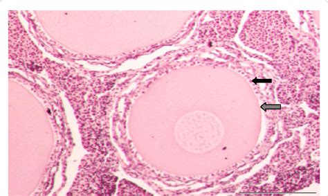 Light microscopy image of an ovarian follicle. The black arrow... | Download Scientific Diagram