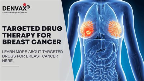 Targeted Therapy For Breast Cancer - Denvax