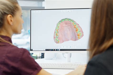 Intraoralinis 3D skeneris – aukščiausiai odontologinių paslaugų kokybei- fi clinica