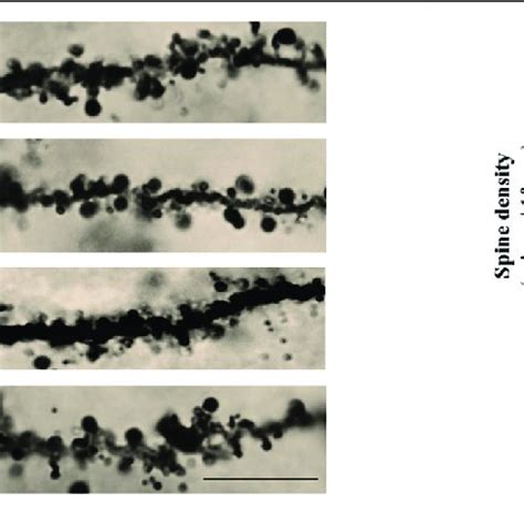 | LPM570065 increased the density of dendritic spines in the ... 