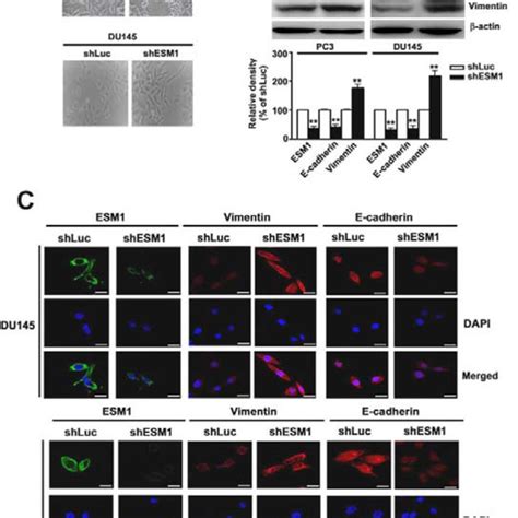 Expression Of ESM1 In Prostate Cancer Cells And Knockdown ESM1 On The