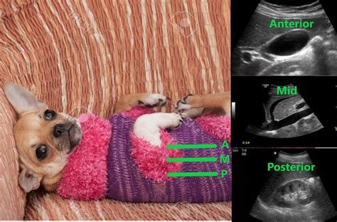 Scanning Efficiency: Getting Right with the RUQ | SonoMojo