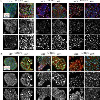 Irf Knockdown Induces Smad Activity And Dissolution Of Cell Junctions