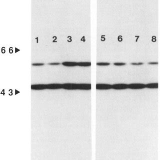 Effect Of P1 Antisense Oligonucleotides On The Induction Of Peripherin