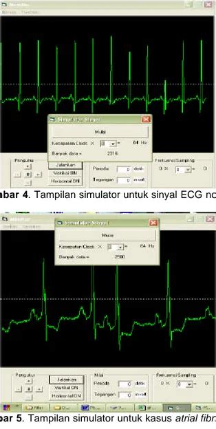 Simulator Ecg Berbasis Pc Sebagai Alat Bantu Ajar Pengolahan Sinyal