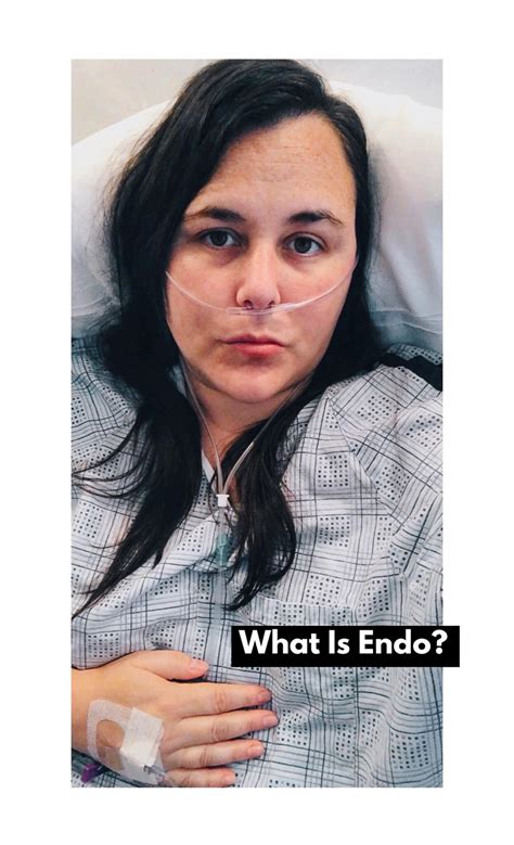 What Is Endo? | Sher Castellano and Living With Endometriosis