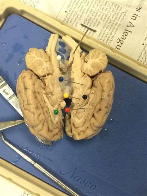 Brain Dissection Diagram