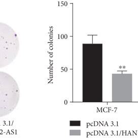 Overexpression Of Hand As Repressed Proliferation Migration And