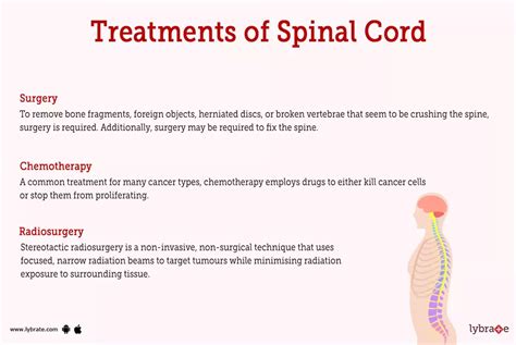 Spinal Cord Human Anatomy Picture Functions Diseases And Treatments