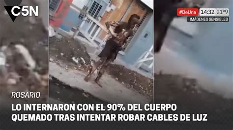 Rosario Lo Internaron Con El 90 Del Cuerpo Quemado Tras Intentar