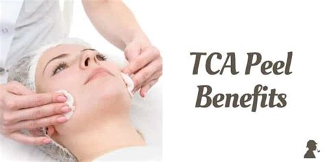 Tca Peel For Acne Scars Everything You Need To Know From Medical