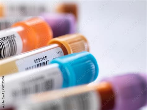 health screening stock photo adobe stock