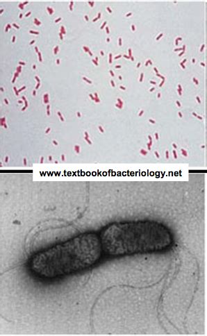 Bordetella Spp Flashcards Quizlet