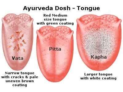 Ayurvedic Tongue Diagnosis Made Easy | Rimedi per la salute, Salute naturale, Yoga per principianti